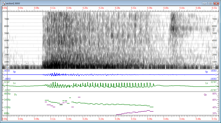 Laryngogram of kick-plus-bass